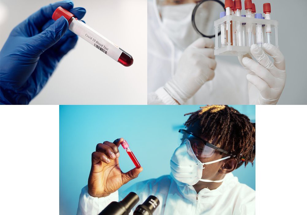 application of vacuum blood collection citrate tube